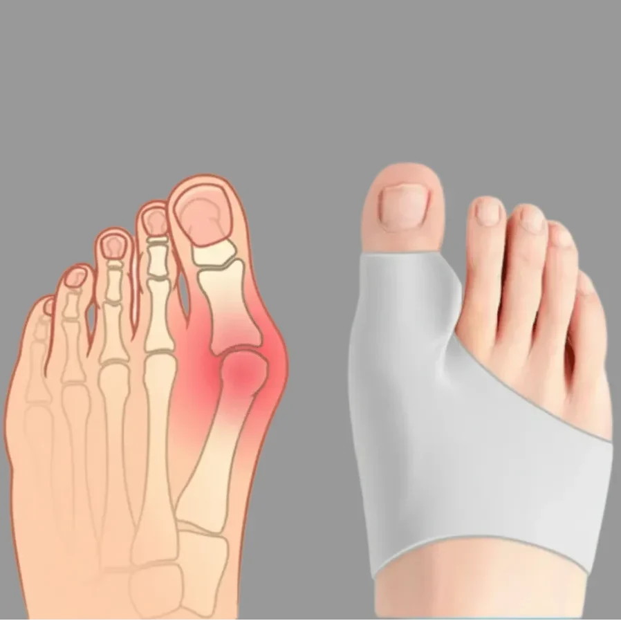 Bunion Corrector Breathable Discreet Under Shoes 2-Pair Set