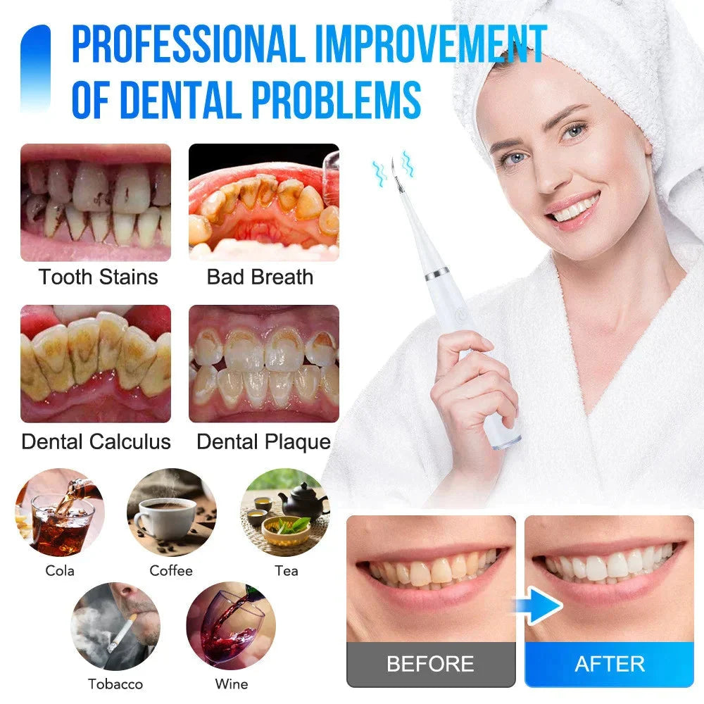 Tooth Cleaner Ultrasonic 5 Adjustable Levels 3 Interchangeable Heads