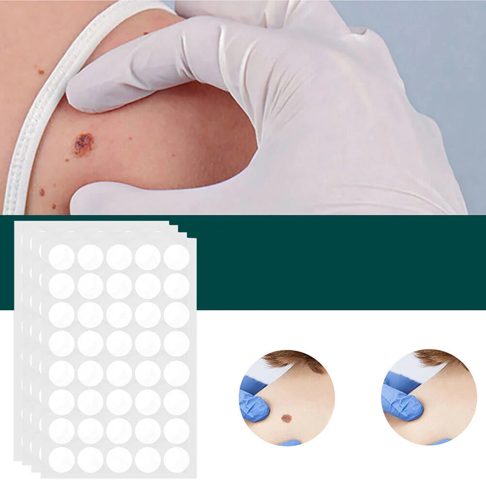 Wart Removal Patches Hydrocolloid Transparent 120 Count