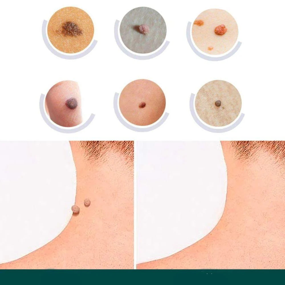 Wart Removal Patches Hydrocolloid Transparent 120 Count