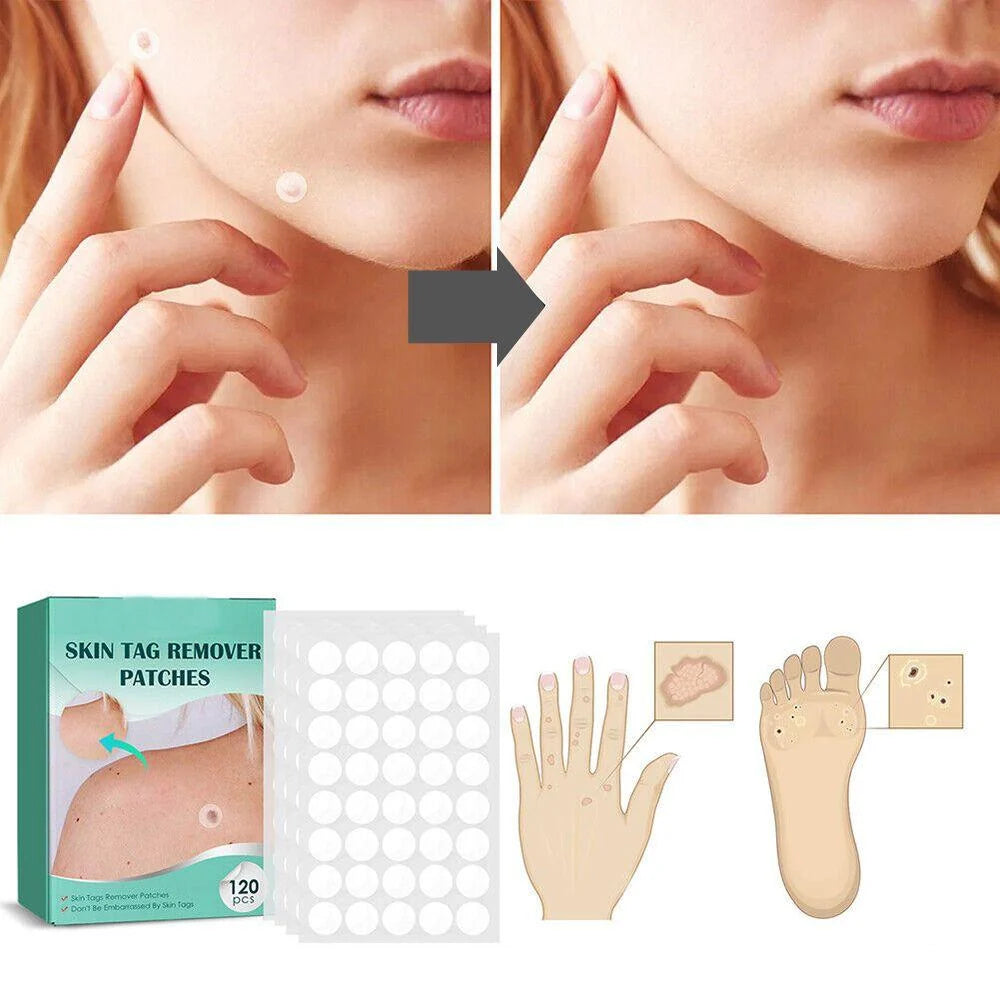 Wart Removal Patches Hydrocolloid Transparent 120 Count